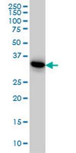 PRPS1L1 Antibody in Western Blot (WB)