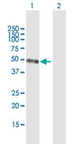 STAC3 Antibody in Western Blot (WB)