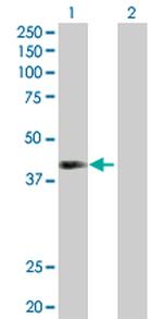 NEIL2 Antibody in Western Blot (WB)