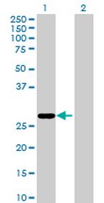 MGC50721 Antibody in Western Blot (WB)