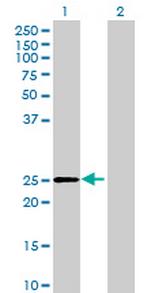 DHRS4L2 Antibody in Western Blot (WB)