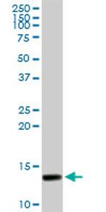 SYCN Antibody in Western Blot (WB)