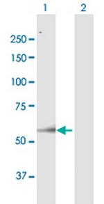 ARSH Antibody in Western Blot (WB)