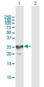 CT45-4 Antibody in Western Blot (WB)