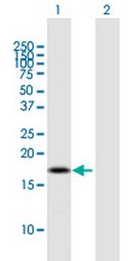 BOLA2B Antibody in Western Blot (WB)