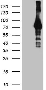 HABP2 Antibody in Western Blot (WB)