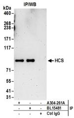 HCS Antibody in Western Blot (WB)