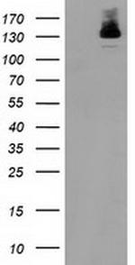 HDAC6 Antibody in Western Blot (WB)