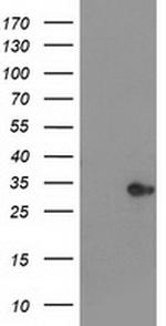 HDHD2 Antibody in Western Blot (WB)