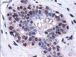 HES1 Antibody in Immunohistochemistry (Paraffin) (IHC (P))