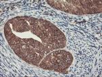 HES1 Antibody in Immunohistochemistry (Paraffin) (IHC (P))