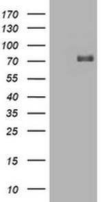 HIF3A Antibody in Western Blot (WB)