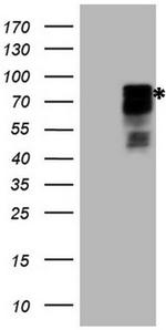 HIPK1 Antibody in Western Blot (WB)