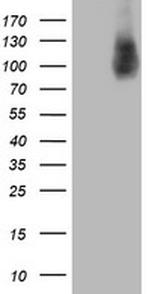 HLCS Antibody in Western Blot (WB)