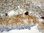 HOMER1 Antibody in Immunohistochemistry (Paraffin) (IHC (P))