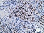 HOXC11 Antibody in Immunohistochemistry (Paraffin) (IHC (P))