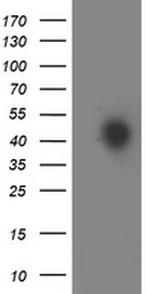 HOXC11 Antibody in Western Blot (WB)