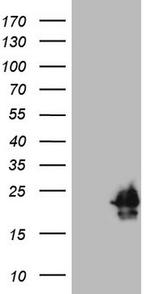 HPCAL4 Antibody in Western Blot (WB)