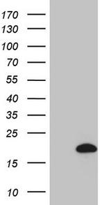 HPCAL4 Antibody in Western Blot (WB)