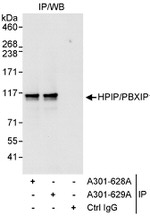 HPIP Antibody in Immunoprecipitation (IP)