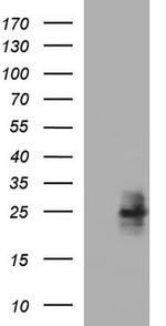 HPRT1 Antibody in Western Blot (WB)