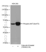 Phospho-AKT (Ser473) Antibody in Western Blot (WB)