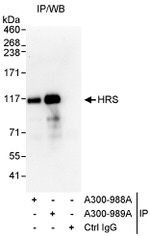 HRS Antibody in Immunoprecipitation (IP)