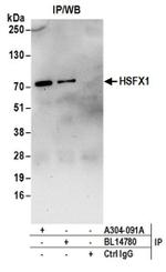 HSFX1 Antibody in Immunoprecipitation (IP)