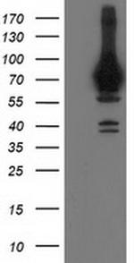 HSPA6 Antibody in Western Blot (WB)