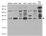 HSPB1 Antibody in Western Blot (WB)