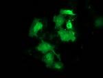 HSPB8 Antibody in Immunocytochemistry (ICC/IF)