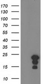 HSPB8 Antibody in Western Blot (WB)