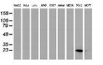 HSPB8 Antibody in Western Blot (WB)