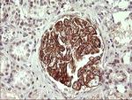 ICAM1 Antibody in Immunohistochemistry (Paraffin) (IHC (P))