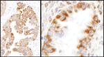 IDH2 Antibody in Immunohistochemistry (IHC)