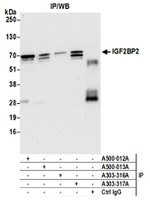 IGF2BP2 Antibody in Western Blot (WB)