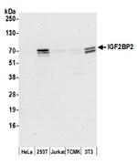 IGF2BP2 Antibody in Western Blot (WB)