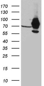 IGF2BP3 Antibody in Western Blot (WB)