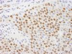 CTBP1 Antibody in Immunohistochemistry (Paraffin) (IHC (P))