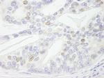 NBS1 Antibody in Immunohistochemistry (Paraffin) (IHC (P))