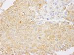 NF-kappaB1 Antibody in Immunohistochemistry (Paraffin) (IHC (P))