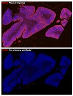 PCNA Antibody in Immunohistochemistry (Paraffin) (IHC (P))