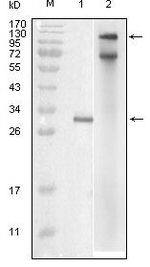 IKK epsilon Antibody in Western Blot (WB)