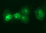 IL6R Antibody in Immunocytochemistry (ICC/IF)