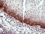 IL6R Antibody in Immunohistochemistry (Paraffin) (IHC (P))