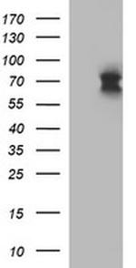 IL6R Antibody in Western Blot (WB)