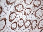 IRS1 Antibody in Immunohistochemistry (Paraffin) (IHC (P))