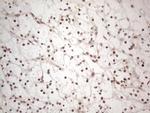 IRS1 Antibody in Immunohistochemistry (Paraffin) (IHC (P))