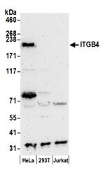 ITGB4/CD104/Integrin beta-4 Antibody in Western Blot (WB)