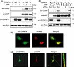 Amyloid Precursor Protein Antibody in Immunocytochemistry (ICC/IF)